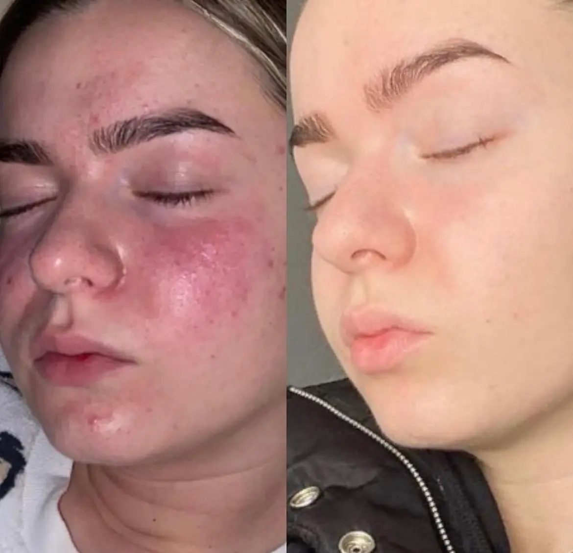 Sea Moss metamorfoza 1