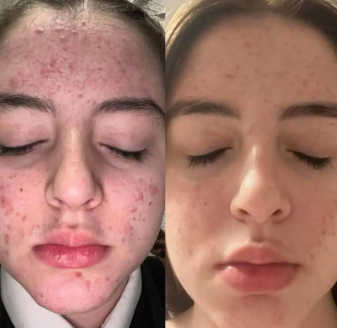 Sea Moss metamorfoza 2