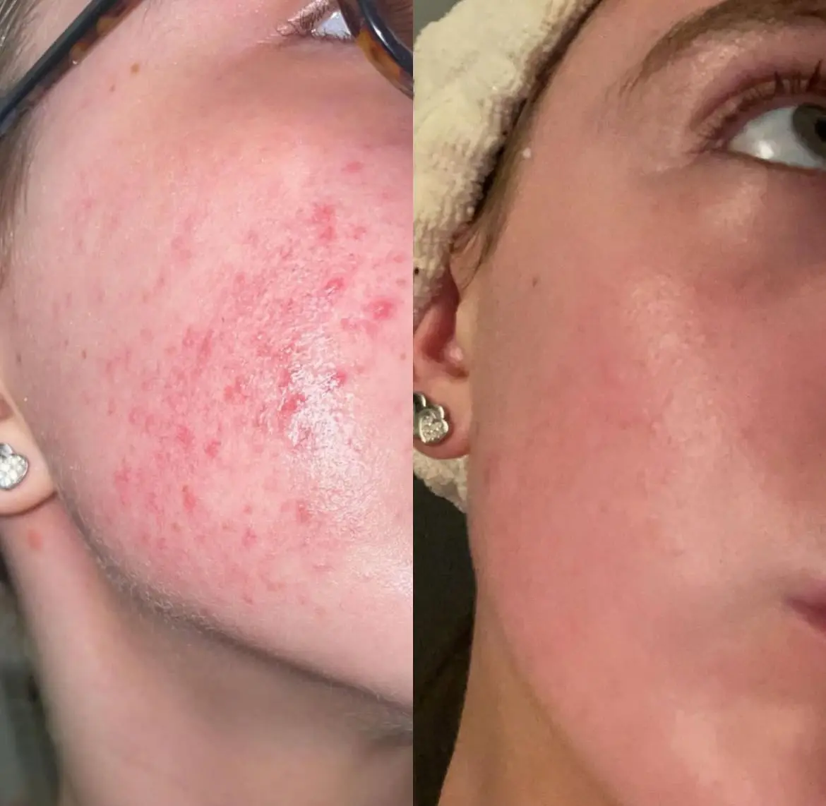 Sea Moss metamorfoza 4