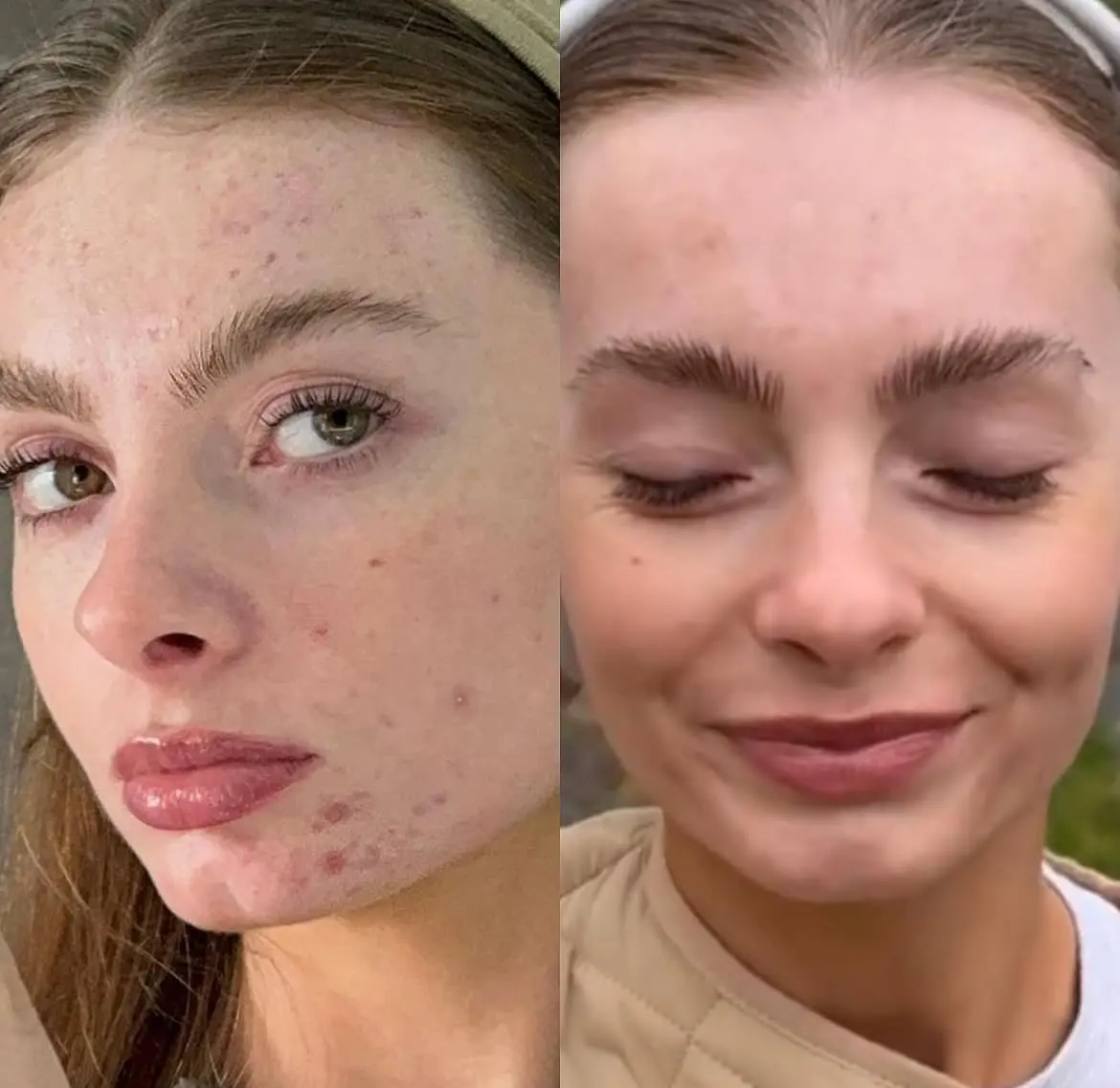 Sea Moss metamorfoza 5