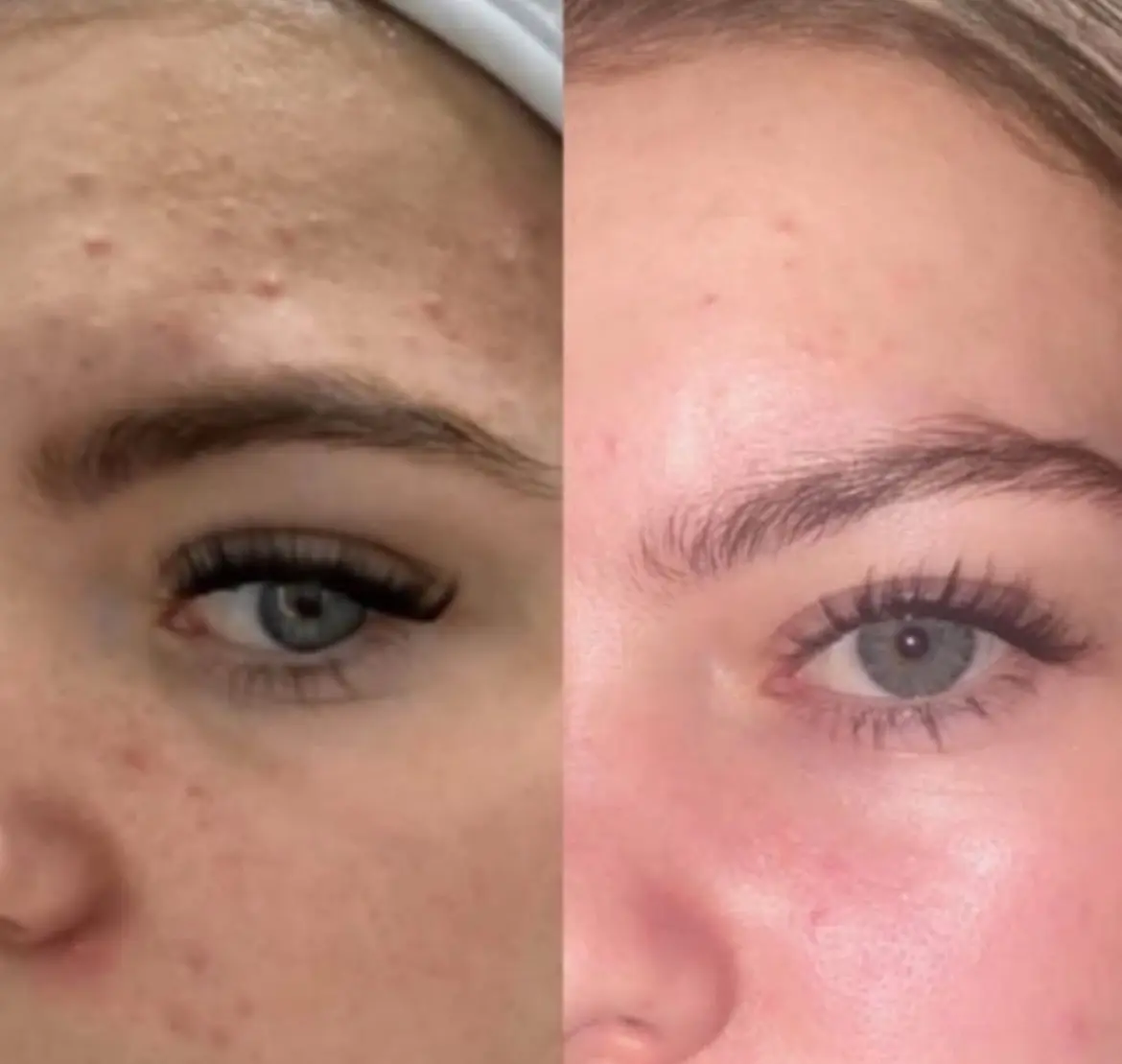 Sea Moss metamorfoza 6